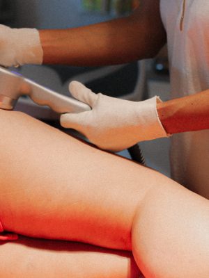 Cellulite Behandlung Karlsruhe